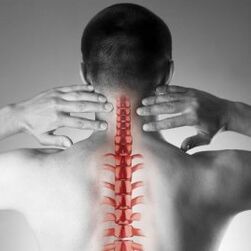 Osteocondrosis cervical