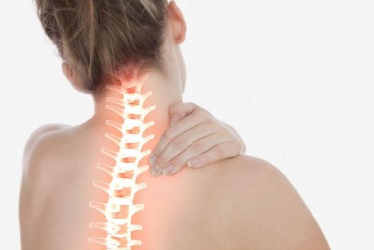 dolor de cuello debido a la osteocondrosis
